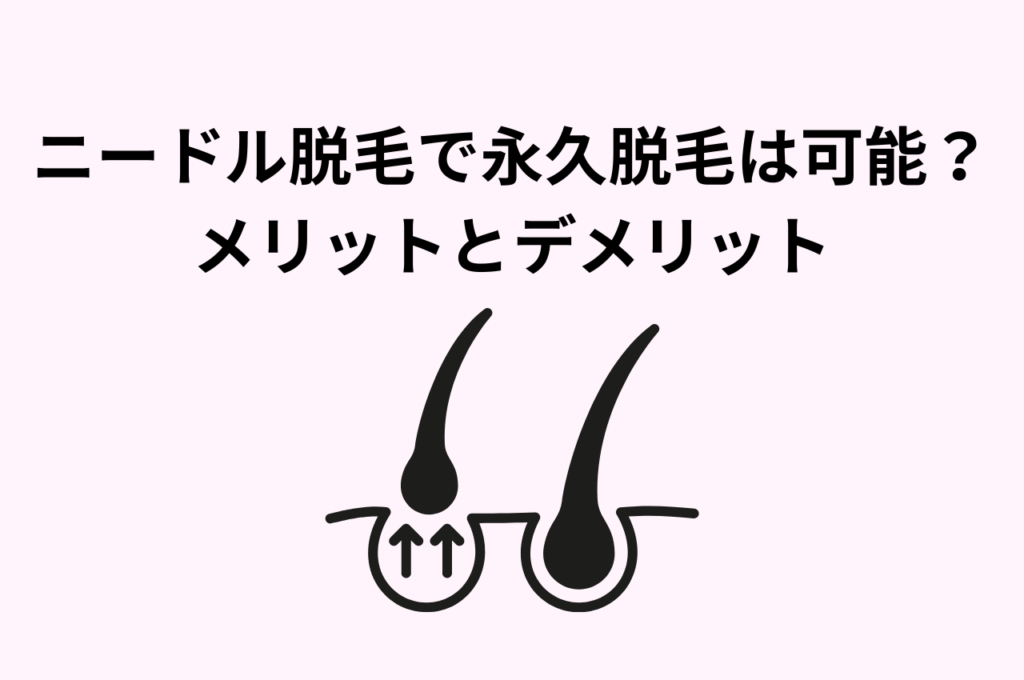 ニードル脱毛で永久脱毛はできる？メリットとデメリットを紹介します！