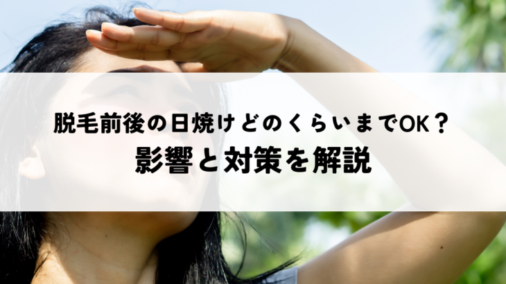 脱毛前後の日焼けどのくらいまでOK？影響と対策を解説