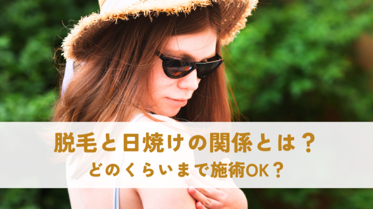 脱毛と日焼けの関係とは？どのくらいまで施術OK？